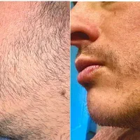 فرم جذاب صورت با ریش پر