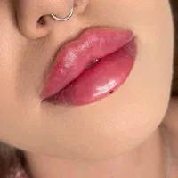 فیلر، ژل، بوتاکس، پی آر پی، لیزر با ۶۰ درصد تخفیف