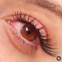 کاشت مژه