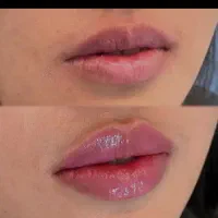 آف ژل ،فیلربادی،کاشت مژه ریسه ای ،اصلاح صورت وابرو