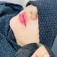 تزریق ژل .بوتاکس .پی ارپی  دکتر اسماعیل آزادی