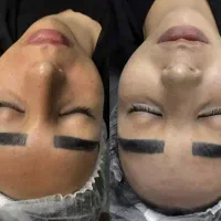 پاکسازی وفیشیال