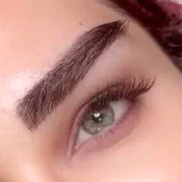 میکروکاشت ابرو و شقیقه بدون جراحی و جراحی