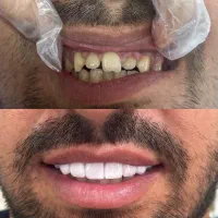 جشنواره دندانپزشکی(تمامی خدمات)