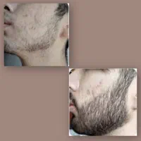 ریش نماد یک مرد کامل