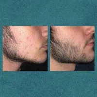 بسازش|آرایشی، بهداشتی، درمانی|زاوه, |دیوار