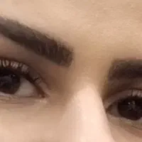 *کاشت مژه موقت*