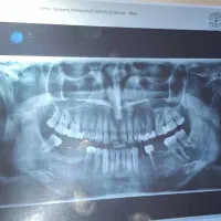 استخدام نیرو پذیرش و رادیولوژی
