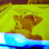 اجاره دستگاه زردی نوزاد100درصدتضنینی کل تهران