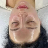 خدمات پوستی فیشیال پاکسازی جوانسازی و... خانم ها