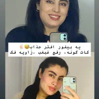 رفع غبغب و زاویه دارشدن صورت با دستگاه