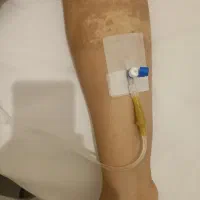 خدمات پرستاری تزریقات حجامت در منزل