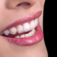 دندانسازی **اقساط ویژه حتی بدون پیش پرداخت **
