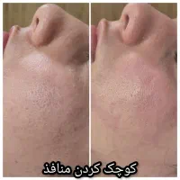 فیشیال تخصصی صورت و بدن با بهترین برندهای روز دنیا