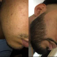 پکیج اروپایی پرپشتی