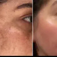 کرم طلا و صابون شراب لای بردار بدون کرتون