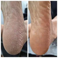 مدل خانوم برای پدیکور