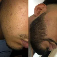 ۳۰ روزه پر پشت میشه