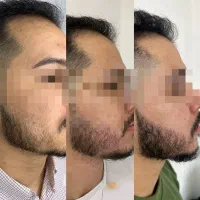 معجزه قرن