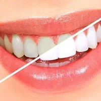 همکاری با دندانپزشک در کلینیک زیبایی