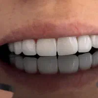 خدمات زیبایی/درمانی دندانپزشکی با هزینه کم