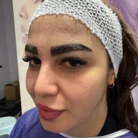 کاشت ابرو اقساطی توسط پزشک