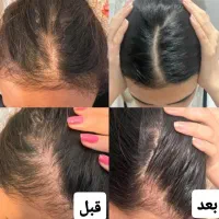 درمان طلایی با طب سنتی