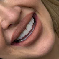 زیبایی ودرمان دندان تخصصی مشاوره رایگان