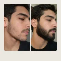 ریش و سبیلته که بهت جذبه میده