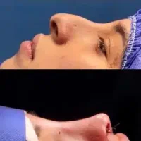 عمل بینی،بندرعباس،اقساطی