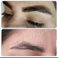 ریموو تتوقدیمی ودکاپاژ ،بسیار ایمن بامواد آمریکایی