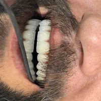 لابراتوار دندانسازی تاج‌
