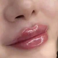 ژل و بوتاکس