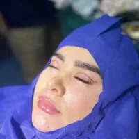 جراحی پلک بلفاروپلاستی اوان کیلینیک