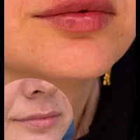 نیازمند مدل