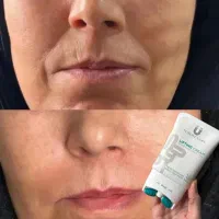 کرم ضدلک وضدچروک