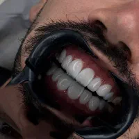 8واحد کامپو زیت فقط 8تومن گارانتی 7 ساله