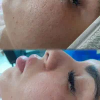 ارائه خدمات تخصصی فیشال درمانی