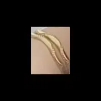 طلا