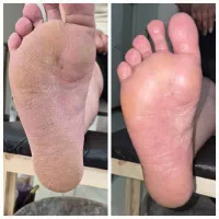 پدیکور درمانی و ریلکسی
