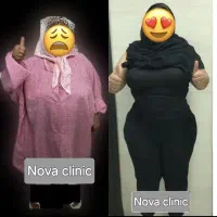 ابدومینوپلاستی/لیپوشکم وران/ژنیکوماستی/براکیوپلاست