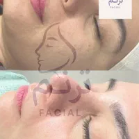 اف عیدقربان فشیالcipتخصصی فقط۴۹۹/کادردرمان/جمهوری