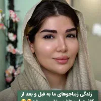 میکرو کاشت دائمی ابرو - اقساط طولانی