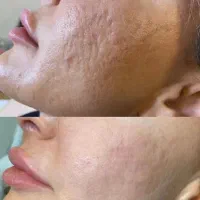 نیازمندمدل خانم و آقا با ترک های پوستی زیاد