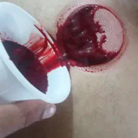 حجامت وماساژ ریلکسی درخانه خودتان انجام می شود
