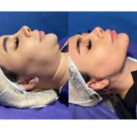 جراح لیپو غبغب بازیگران با سابقه ۸۰۰۰ جراحی