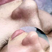 فیشیال تخصصی با تخفیف ویژه و ظرفیت محدود فقط۴۵۰ت