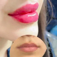 جشنواره آموزش فیشیال تخصصی کمترین قیمت درتبریز