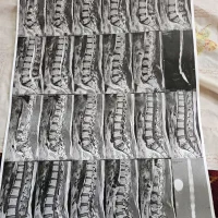 زالو،حجامت،فصد خون،مشاوره طب سنتی|خدمات زیبایی و سلامت|یزد, |دیوار
