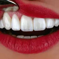 کامپوزیت از دم قسط